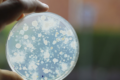 Mikrobieller Schadstoffabbau